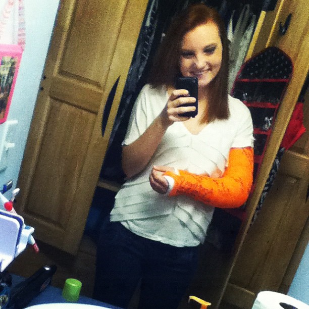 Casts and Toes Arm Casts!!!