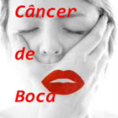 Cancer de boca causas