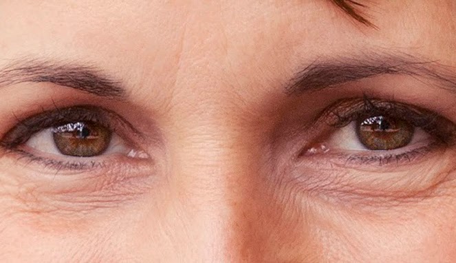 4 Tips Kencangkan Kulit Bawah Mata