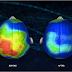 Neuroscientists Discover a Song That Reduces Anxiety By 65 Percent (Listen)