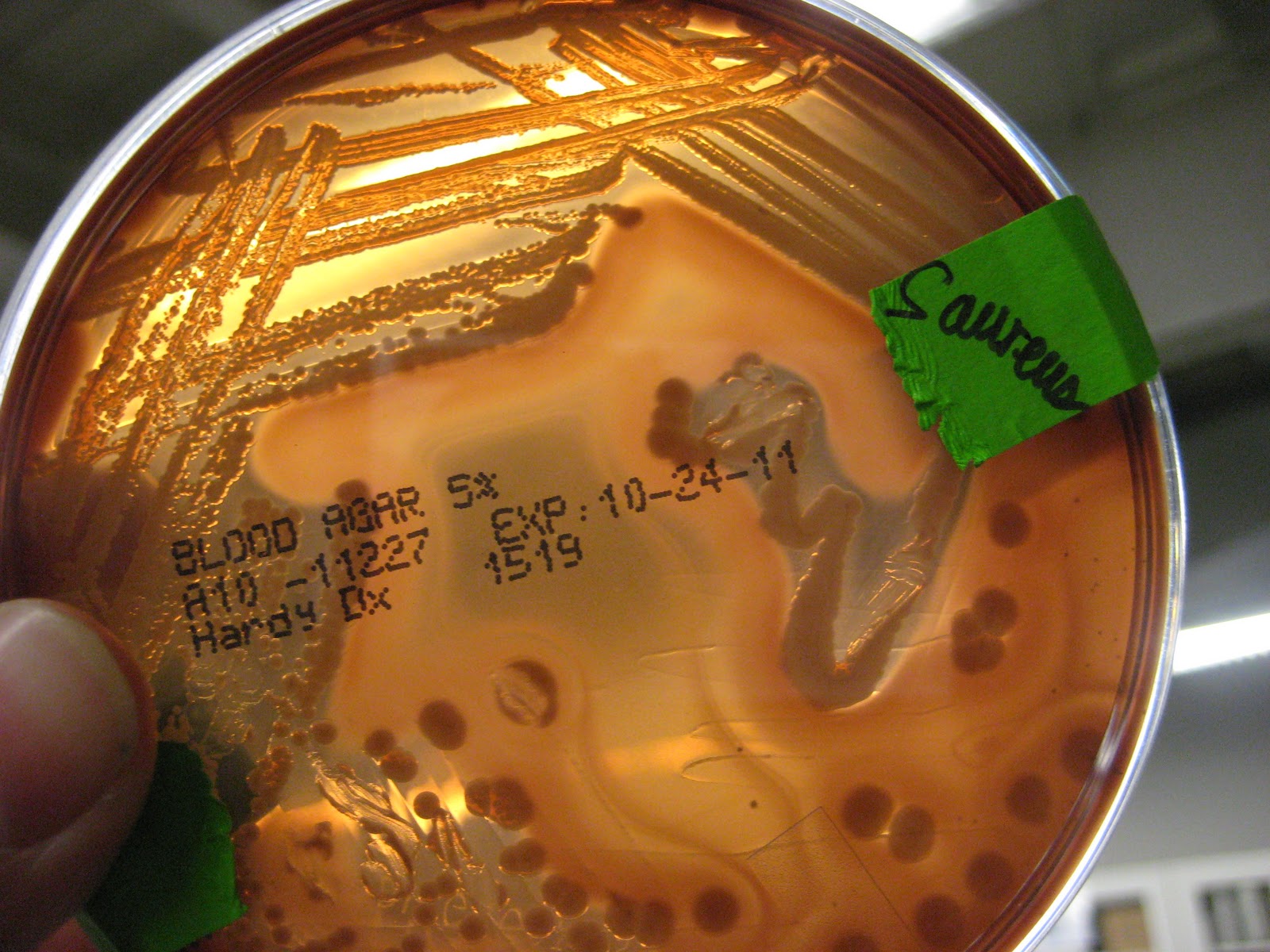 DVC Microbiology 146 Fall 11 (Gard) Lab 34 Throat Culture