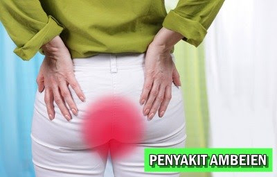 Foto Obat Herbal Agar Ambeien Tidak Keluar Lagi Terbaik