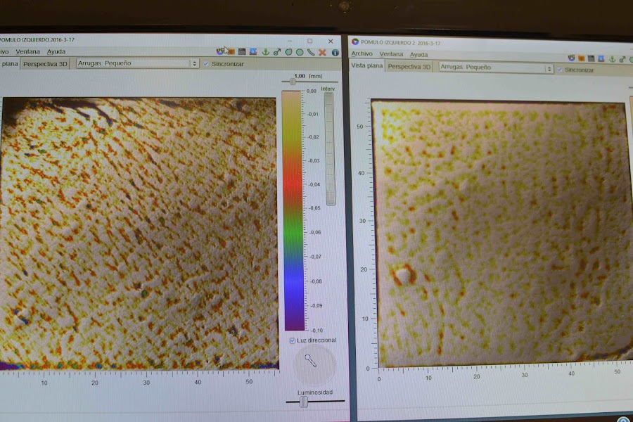 "Skin Genomic Center Barcelona"