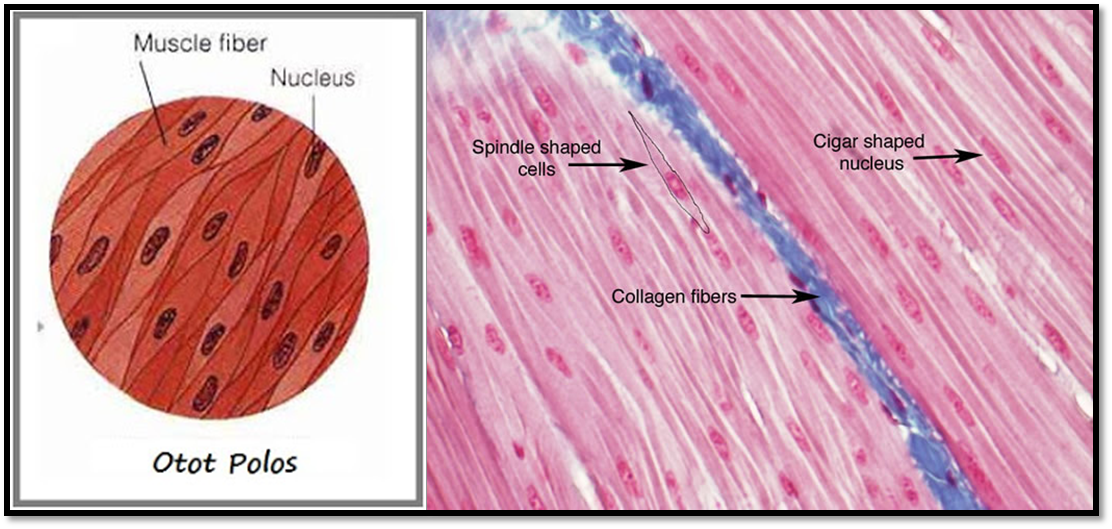 Jika dilihat dengan mikroskop sel otot lurik berbentuk