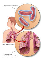  To learn more about the infection-fighting qualities of colloidal silver see www.TheSilverEdge.com...