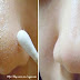 How To Remove Blackheads From Nose & Face – Indian Secret!