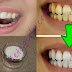 GUARANTEED! WHITEN YOUR YELLOW TEETH IN LESS THAN 2 MINUTES
