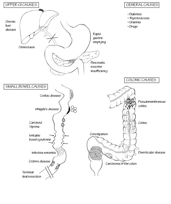 Surgery At a Glance: Diarrhoea
