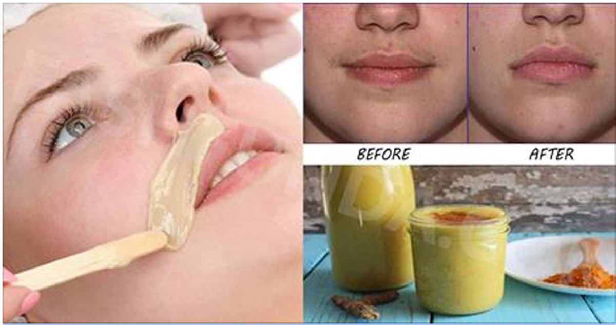 Best way to remove women's upper lip hair Outlet