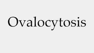 ovalocytosis-www.healthnote25.com