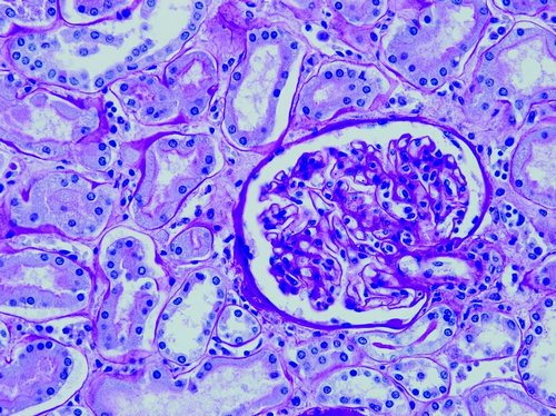 Pas Stain (Periodic acidSchiff stain) eMedicalHelp