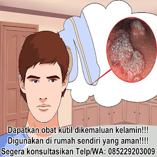 Obat kutil kelamin