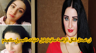 لن تصدق شكل الراقصة صافيناز قبل عمليات التجميل ستنصدم بجد من شكلها!!! لن تصدق شكل الراقصة صافيناز قبل عمليات التجميل ستنصدم بجد من شكلها!!!