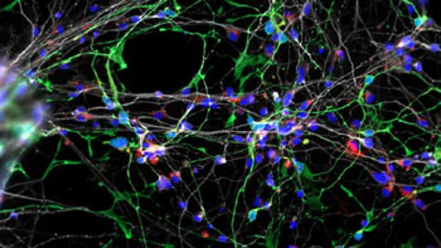 Resultado de imagen de Conectar el cerebro para medir su capacidad