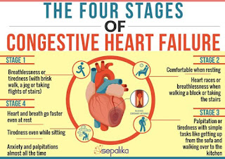 How do Physicians Treat Congestive Heart Failure?