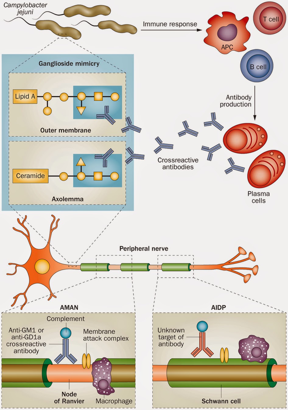 anakkedokteran GuillainBarre Syndrome