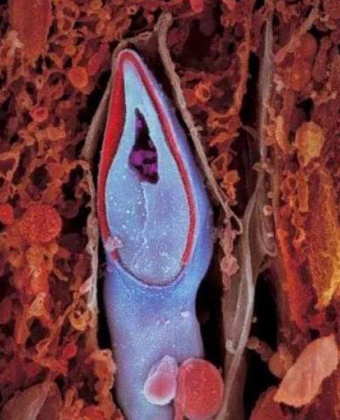 Bebeklerin Anne Karnındaki Fotoğrafları