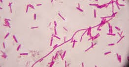 Mengenal Lebih Dekat Clostridium Botulinum Biologi Edukasi Belajar Sains Biologi