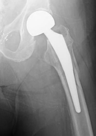 Interesting Topics in Orthopedic Surgery by Dr. Nasar