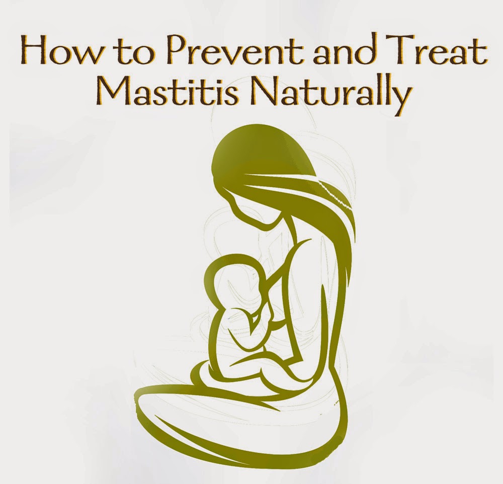 How to Prevent and Treat Mastitis Naturally