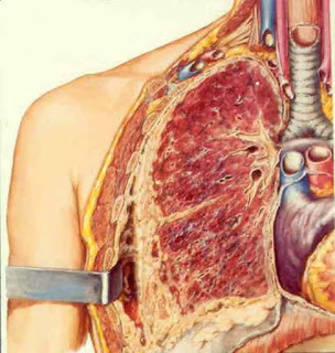 Mesothelioma Symptoms Mesothelioma Symptoms
