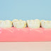 Des scientifiques découvrent un médicament qui régénère les dents endommagées