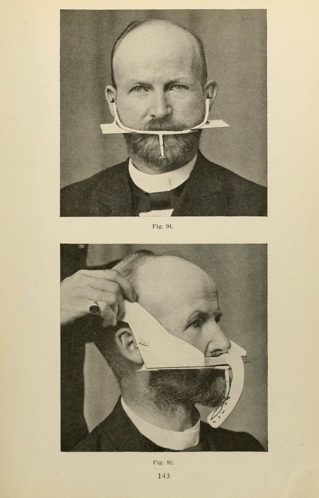 Pictures From 1914 Book Show the Principles of Impression Taking and