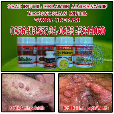 Foto Nama Obat Kondiloma Akuminata Tanpa Operasi