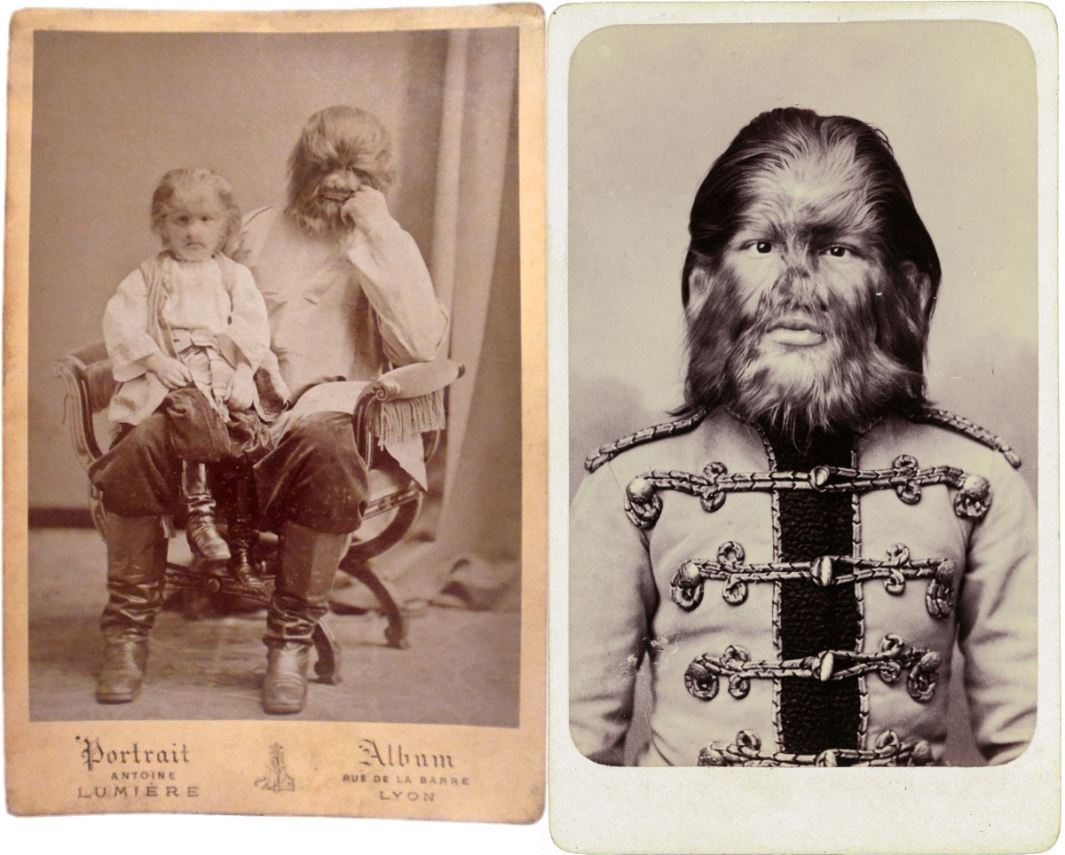 Freak Show — A História do show de aberrações dos Irmãos Ringling ZONA 33 Freak Show — A História do show de aberrações dos Irmãos Ringling ZONA 33