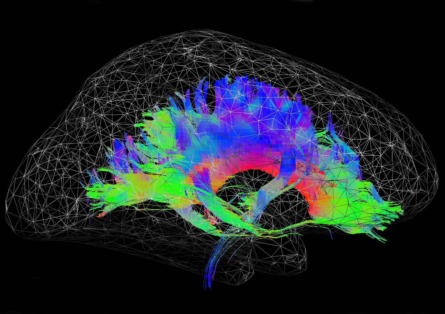 Скорость нейронов в мозге. Нейроны мозга. Визуализация мозга. Нейронный мозг. Нейронная сеть мозга.
