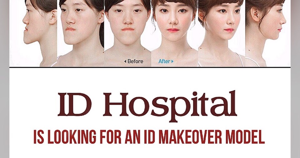 ID Hospital Korea ID Hospital is looking for an ID Makeover Model