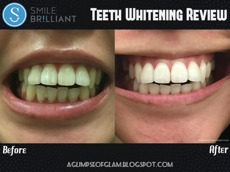 Smile Brilliant Review PLUS A GIVEAWAY A Glimpse of Glam