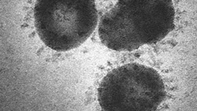 Universitas Stanford Ungkap Virus Corona Berasal dari Perdagangan Kotoran Kelelawar Universitas Stanford Ungkap Virus Corona Berasal dari Perdagangan Kotoran Kelelawar