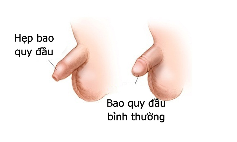 dau-hieu-nhan-biet-benh-nam-khoa-3