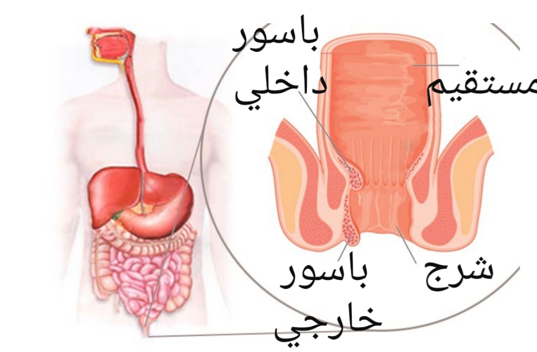 المشبك الدلالة Springboard ماهي اعراض البواسير الداخلية Dsvdedommel Com