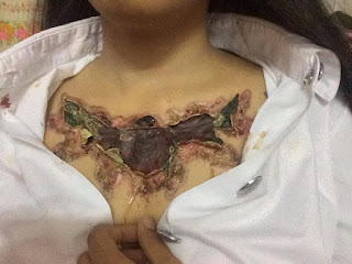 Se hace un tatuaje y su madre la obliga a quitarselo con cremas ácidas