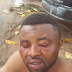 Photos: Two brothers allegedly brutalized by thugs in Edo State for defending 'helpless traders'