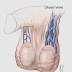 CIRI CIRI VARIKOKEL SUDAH PARAH PADA TESTIS