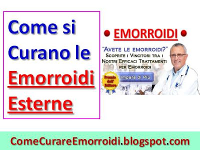Come Capire se Hai le Emorroidi Interne: 9 Passaggi