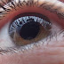 What Is Cataracts? Causes, Prevention And Treatment
