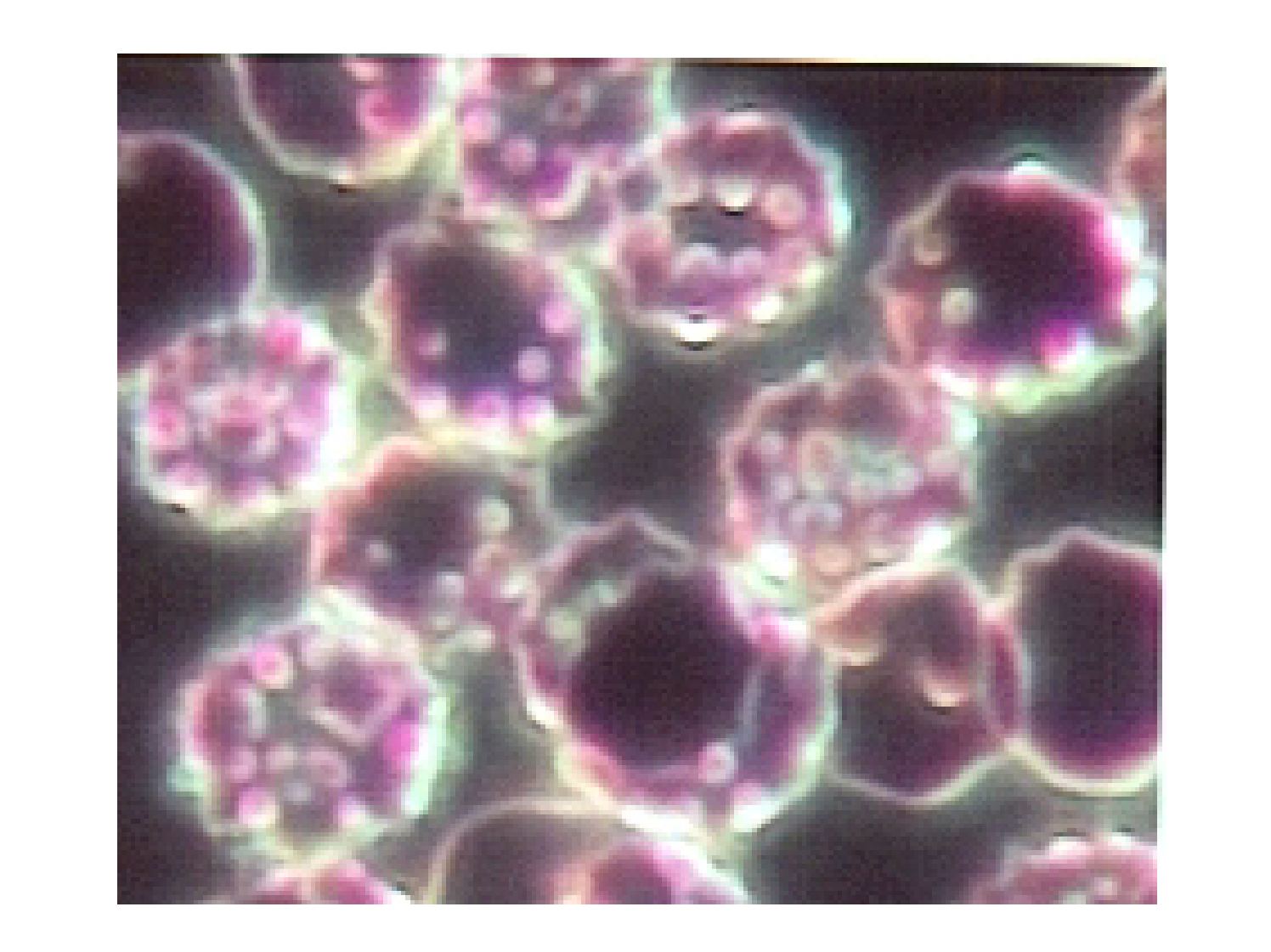 Хламидия 5. Хламидия пневмония под микроскопом. Хламидийная пневмония возбудитель.