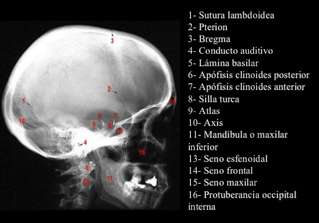 ANATOMÍA: Tejido óseo. EL CRÁNEO. TC, TAC, Rx, RADIOGRAFÍA.