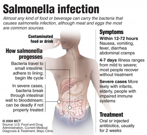 Food Poisoning Muscle Pain Food Poisoning Muscle Pain