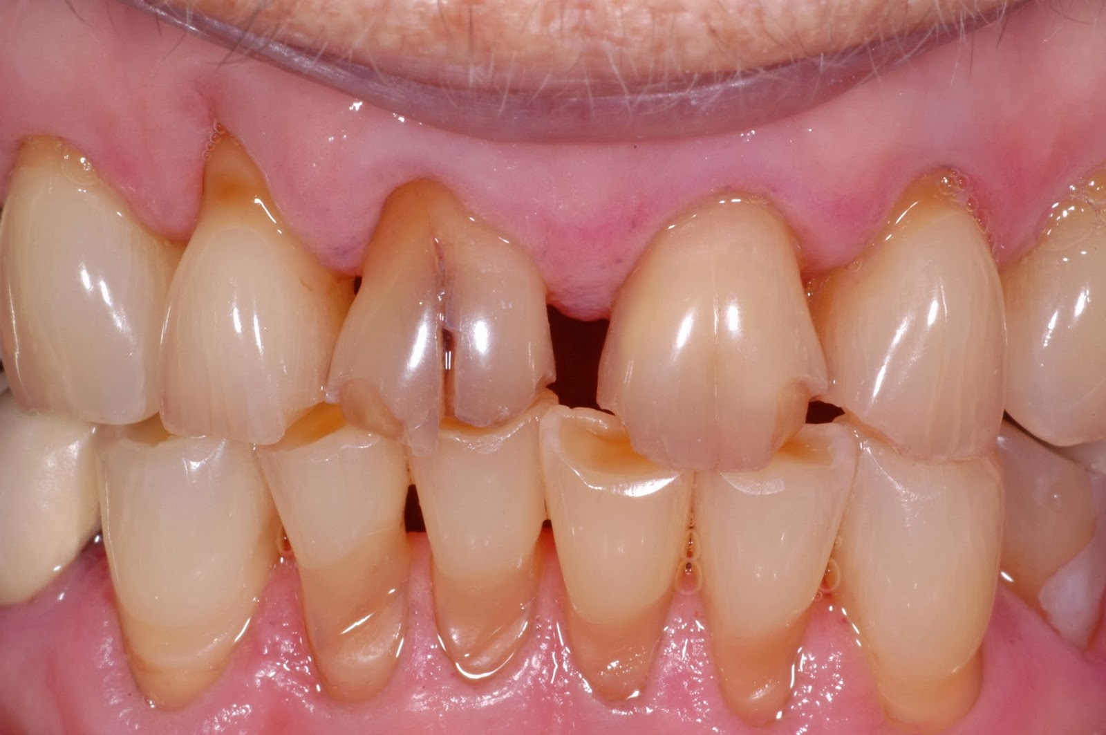 The Buzz from Your Favorite Dental Hygienists Attrition