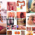 Diare (Mencret) Kronis, Bisa Memicu Wasir Hemoroid thumbnail