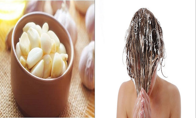 Manfaat Bawang Putih Untuk Mengatasi Rambut Rontok