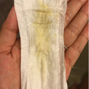 Foto Obat Manjur Untuk Kemaluan Keluar Nanah Yang Tidak Sakit