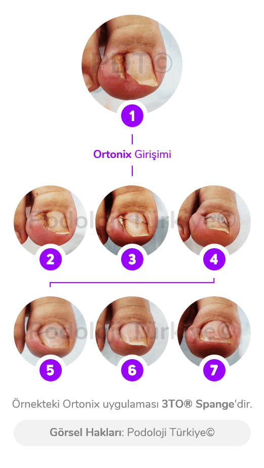 Ortonix Yaklaşımı