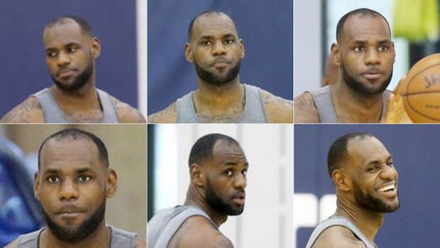 Did Lebron James Have a Hair Transplant? ESPN First Take