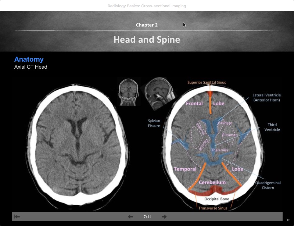 Radiologia en Radiology Basics Crosssectional Imaging An E
